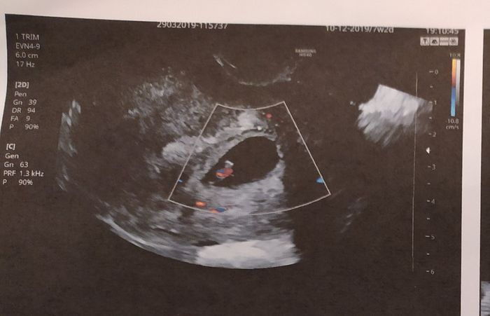 Metodo Ramzi! Chi ci sa azzeccare? - 1