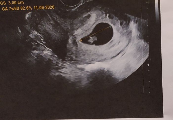 Metodo Ramzi! Chi ci sa azzeccare? - 1