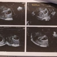 Metodo Ramzi! Chi ci sa azzeccare? - 1