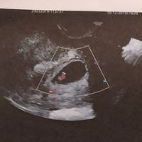 Metodo Ramzi! Chi ci sa azzeccare? - 1