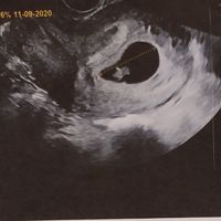 Metodo Ramzi! Chi ci sa azzeccare? - 1