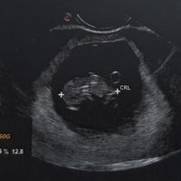 Future mamme Agosto 2021! - 1