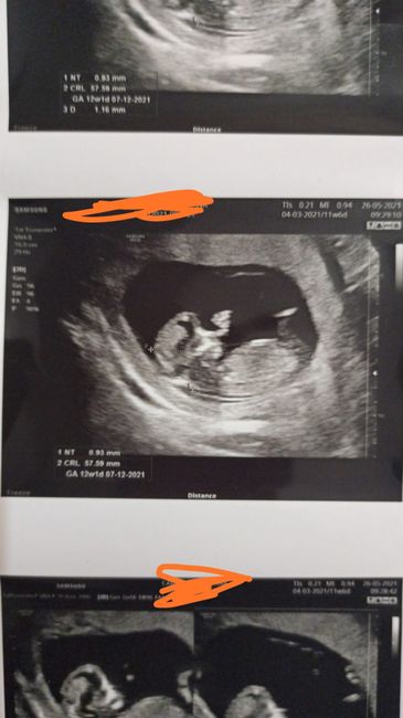 Future mamme Dicembre 2021 🎄🎁💙🎀 - 1