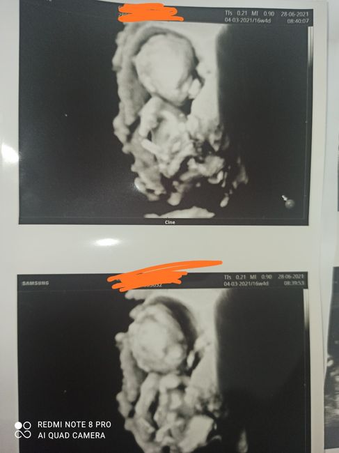 Future mamme Dicembre 2021 🎄🎁💙🎀 - 1