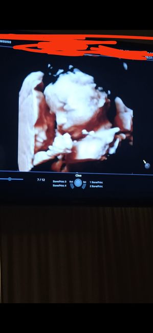 Future mamme Dicembre 2021 🎄🎁💙🎀 - 1