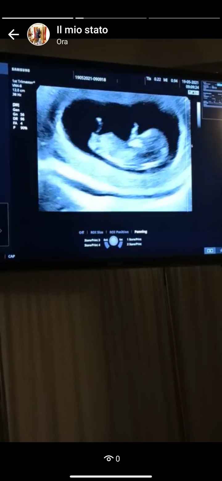 Future mamme Dicembre 2021 🎄🎁💙🎀 - 1