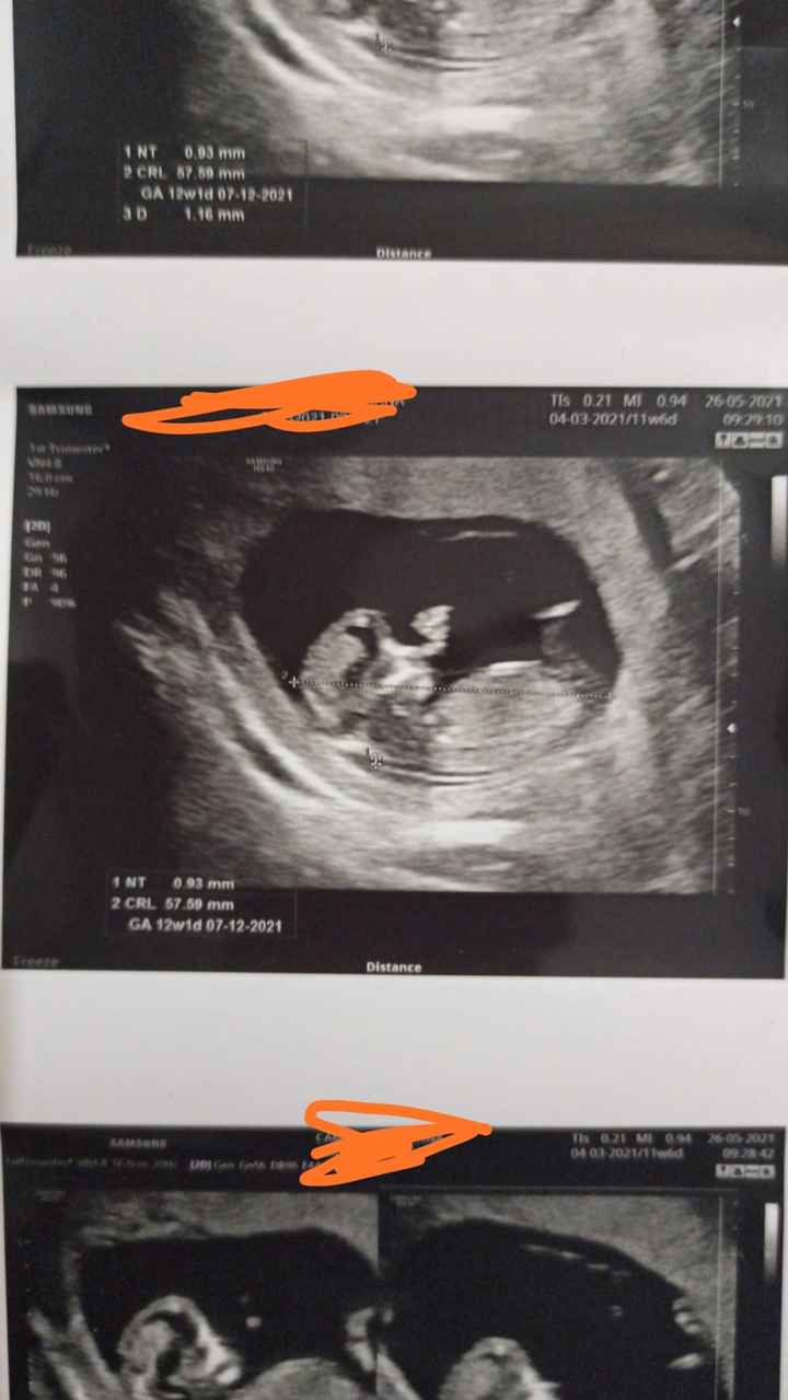 Future mamme Dicembre 2021 🎄🎁💙🎀 - 1