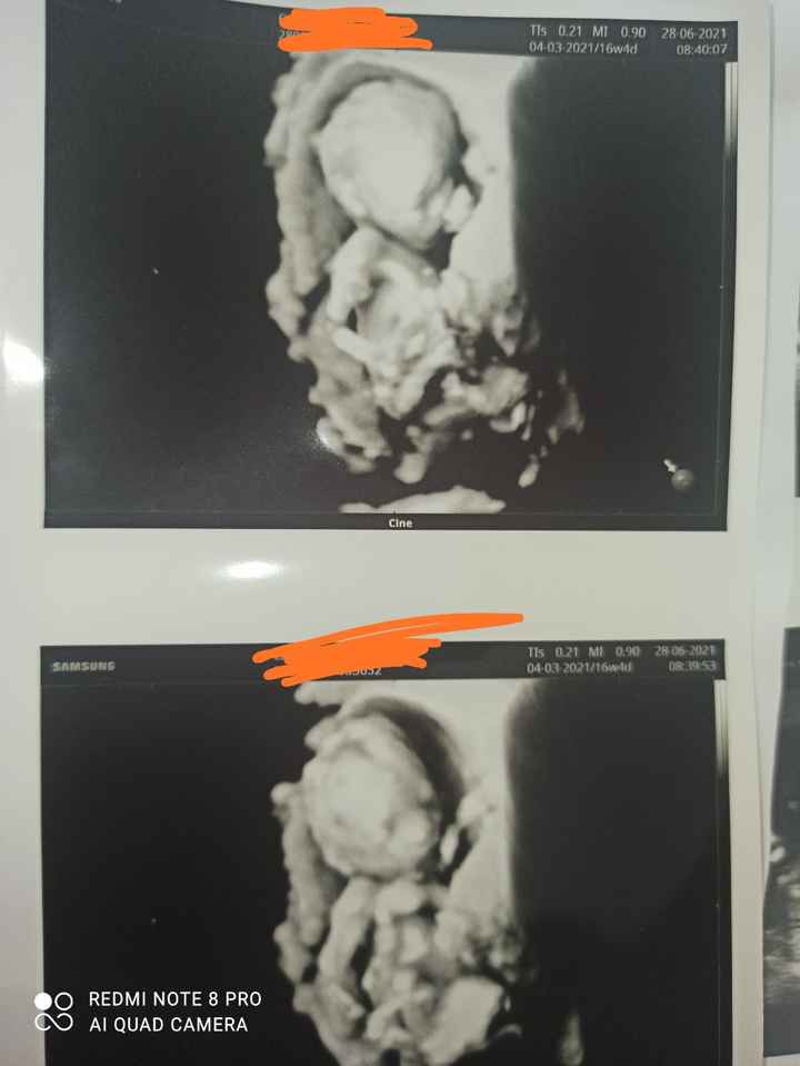 Future mamme Dicembre 2021 🎄🎁💙🎀 - 1