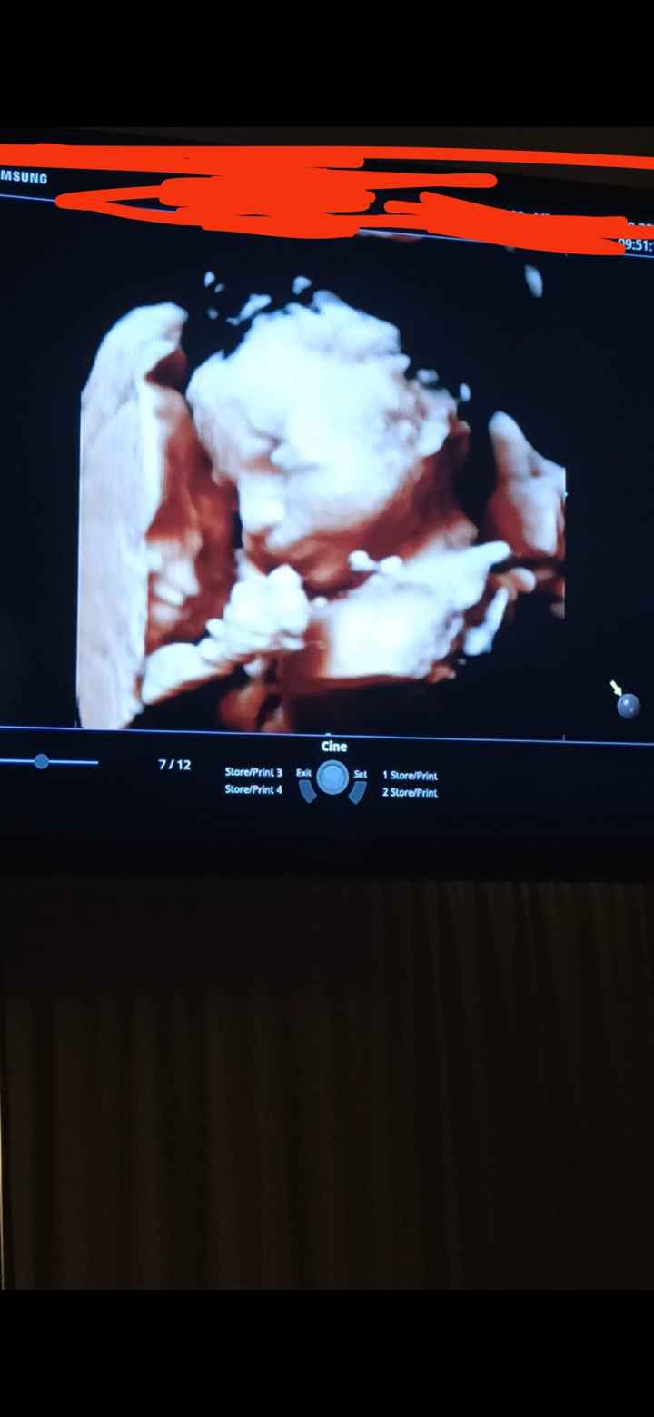 Future mamme Dicembre 2021 🎄🎁💙🎀 - 1