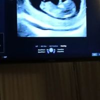 Future mamme Dicembre 2021 🎄🎁💙🎀 - 1