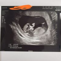 Future mamme Dicembre 2021 🎄🎁💙🎀 - 1