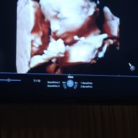 Future mamme Dicembre 2021 🎄🎁💙🎀 - 1