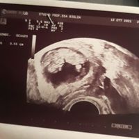 💙💜future mamme di Maggio 2022💙💜 - 1