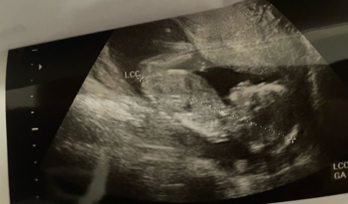 Future mamme Giugno/Luglio 2025 ❤️ 1