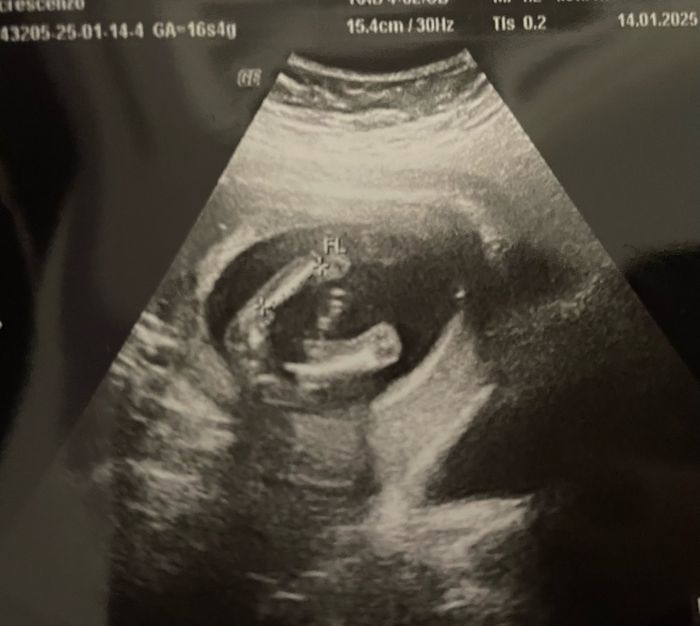 Future mamme Giugno/Luglio 2025 ❤️ 2