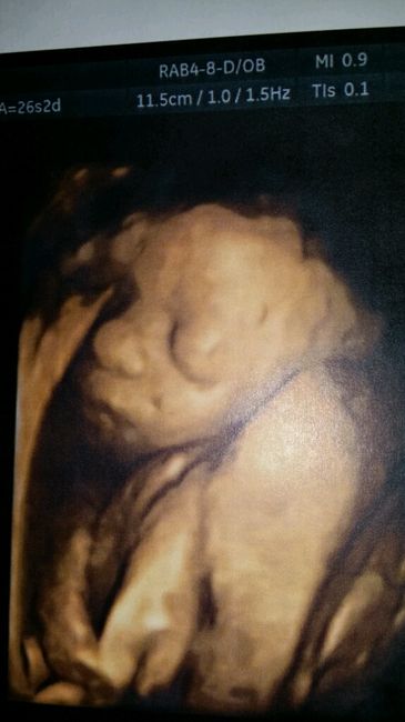 Baretto, ovvero chiacchere da mamme - 1