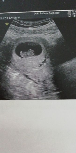 Future mamme di novembre 2