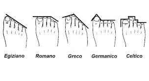 La forma del tuo piede è... - 1