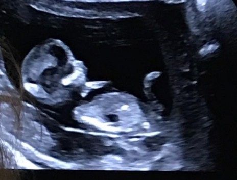 Metodo ramzi... Secondo voi? 1