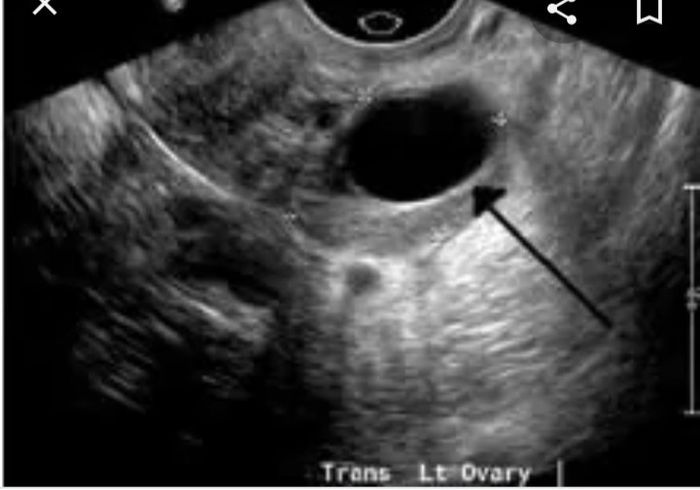 Non sò se potete aiuarmi... 2