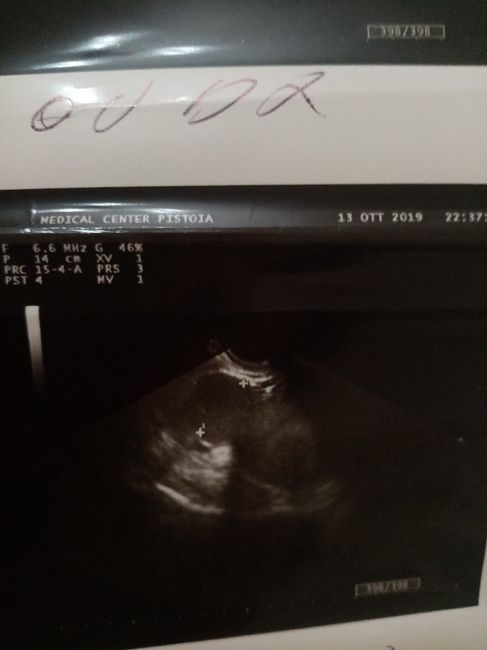 Non sò se potete aiuarmi... 2