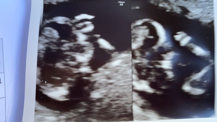 Future Mamme Febbraio 2021 - 2