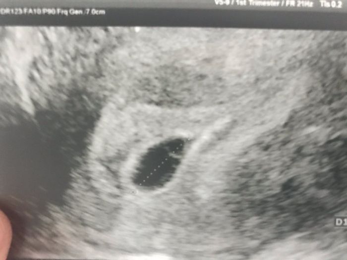 Future mamme ottobre 2020 1