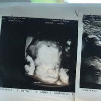 Future mamme novembre 2020 🌞🍁🌷♾ - 1