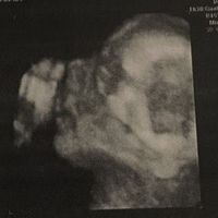 eco morfologica in 3d