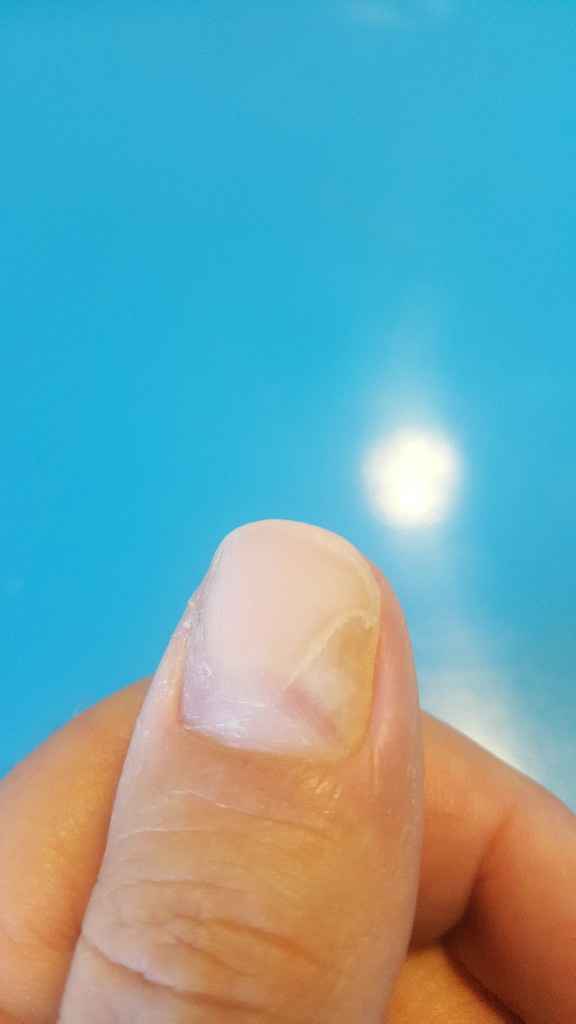  Unghia saltata.. - 1