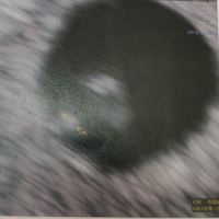 Future mamme di Aprile 2021 🐣 - 1