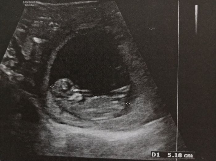 Future mamme Dicembre 2022 - 1
