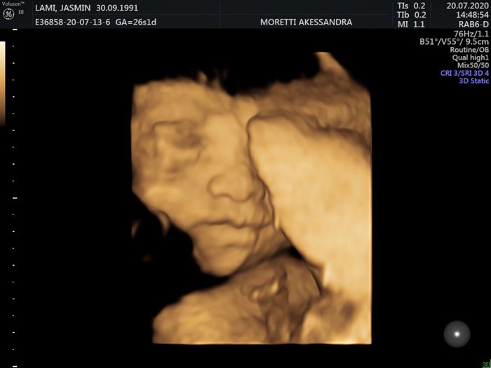 Future mamme ottobre 2020 1