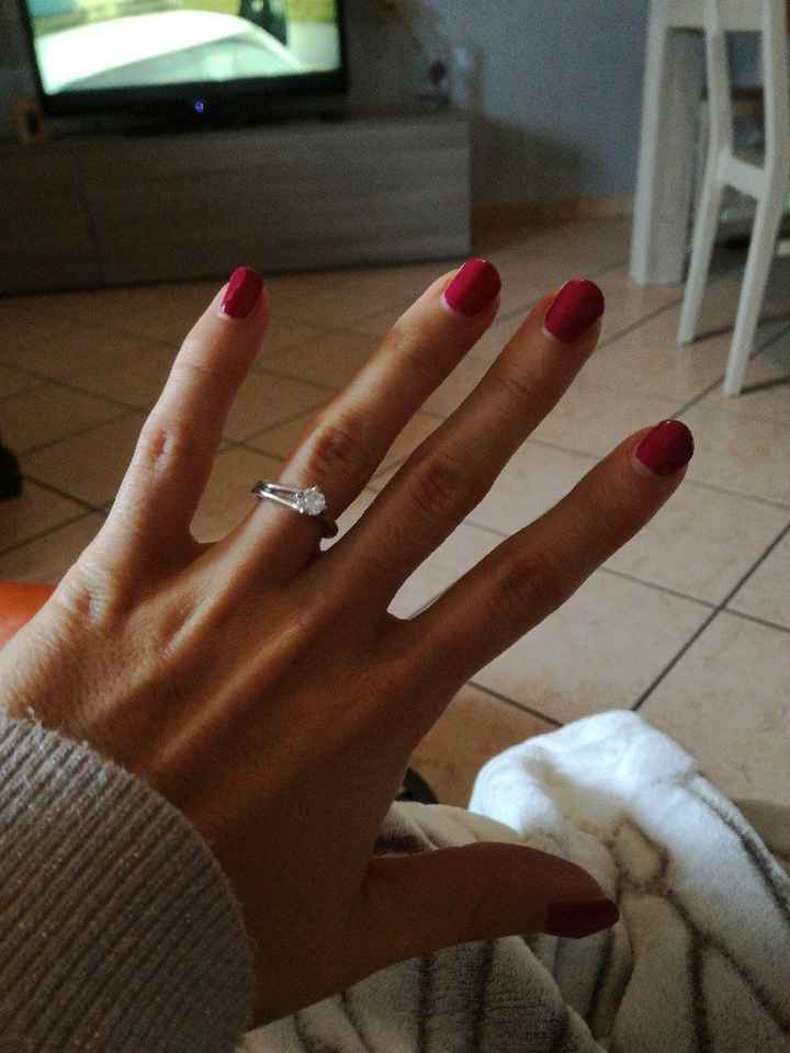  Anello - 1