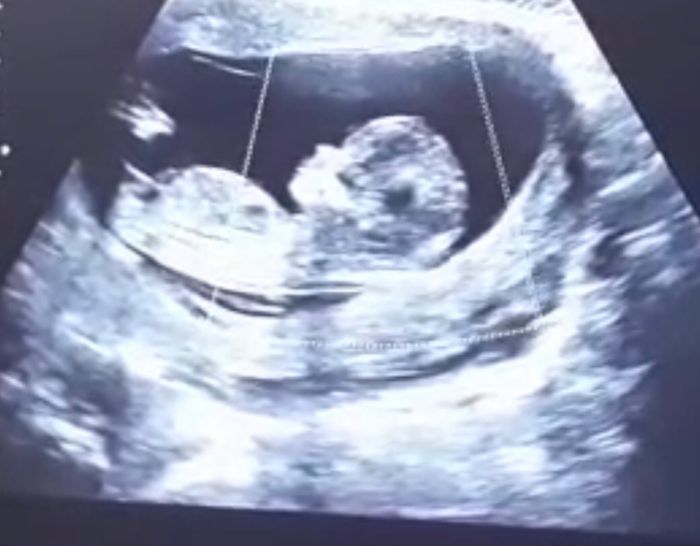 Mamme luglio 2020 1