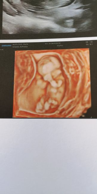 Future mamme Dicembre 2021 🎄🎁💙🎀 - 1