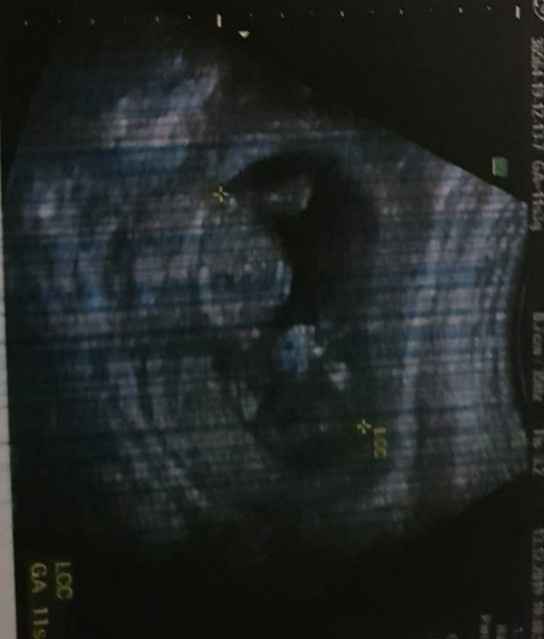 Esperte metodo ramzi e nub theory a me!!😌 - 2