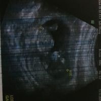 Esperte metodo ramzi e nub theory a me!!😌 - 2