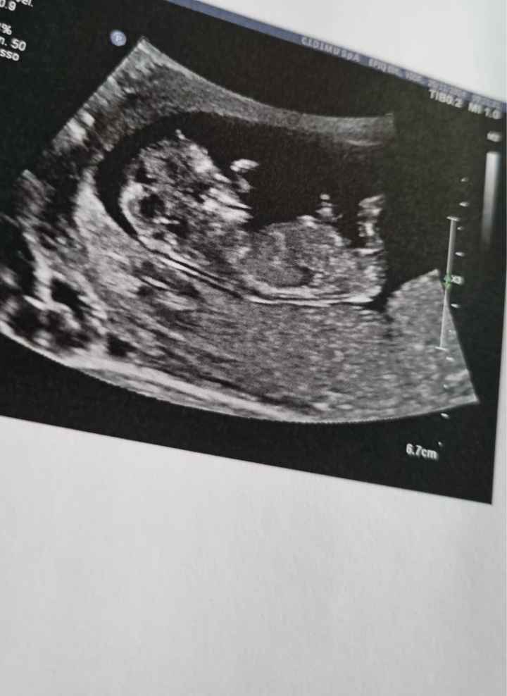 Nub theory, giochiamo un po’ - 2