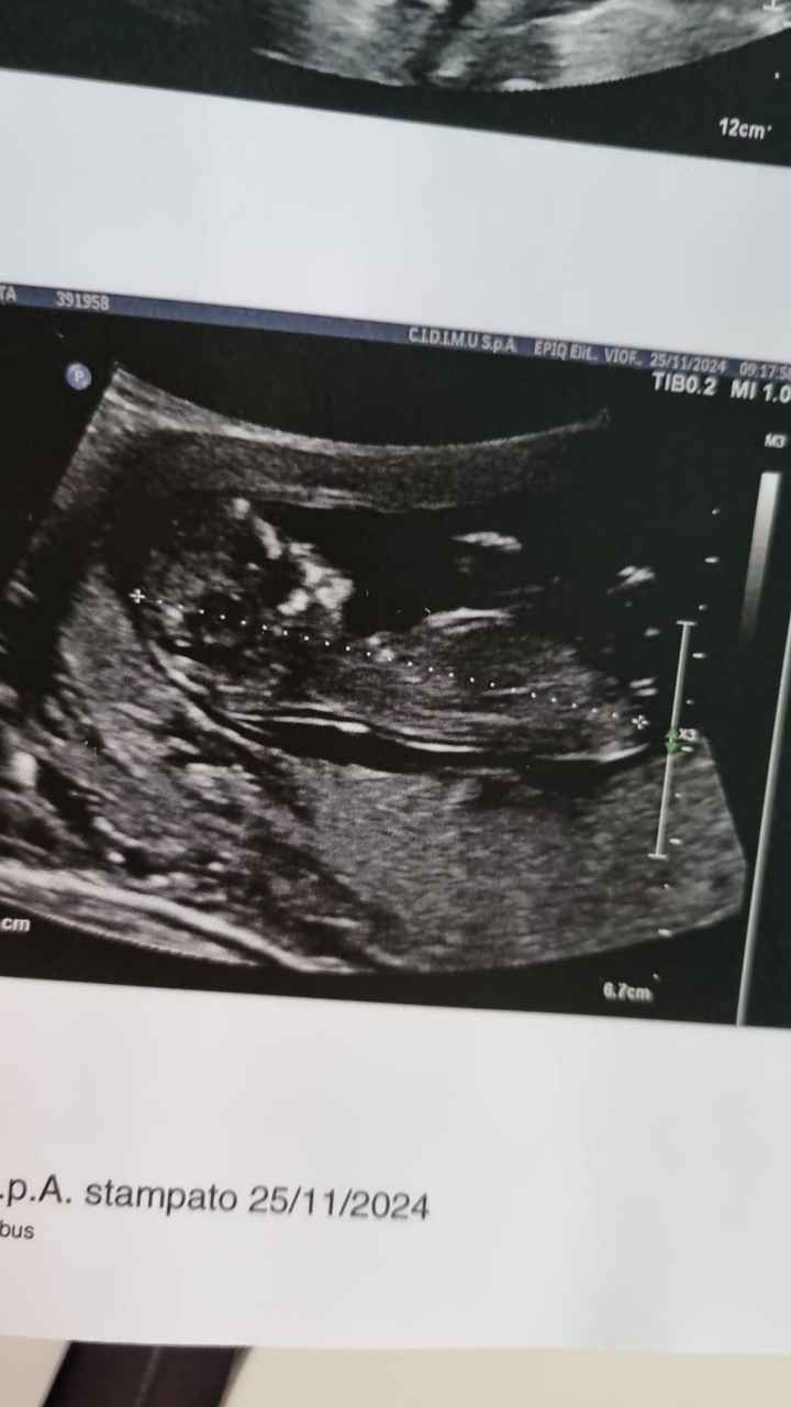 Nub theory, giochiamo un po’ - 3