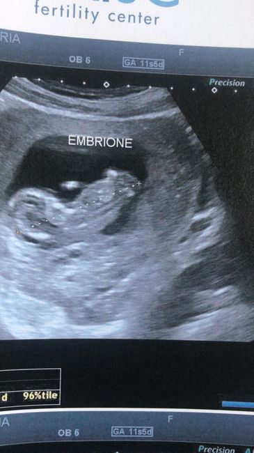 Maschio o femmina ??? - 1