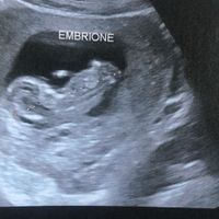 Maschio o femmina ??? - 1