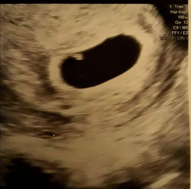 Raschiamento!? Com'è andata? 1