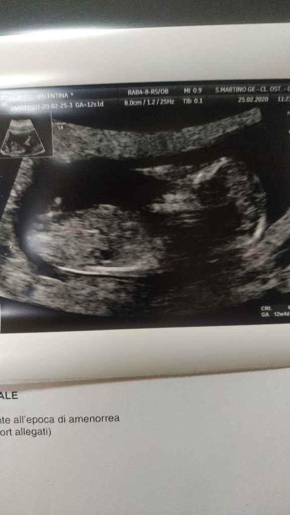 Mamme di Agosto 2020😍🤞😍 - 1