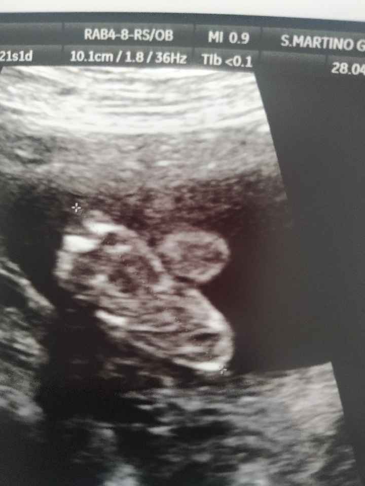 Mamme Settembre 2020❤️ - 1