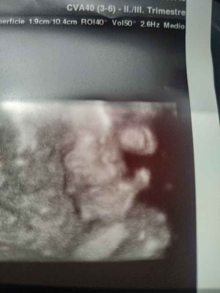 Mamme di Agosto 2020😍🤞😍 - 2