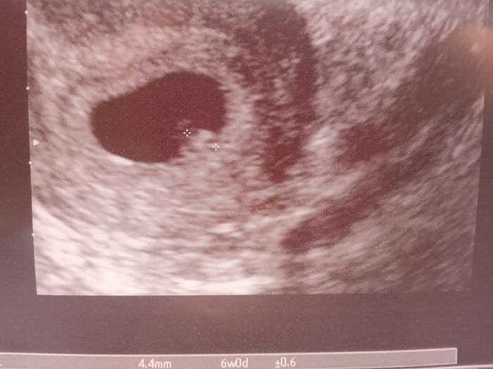 Vi presento il mio secondo miracolo 🍀🤞🙏❤🥰 5