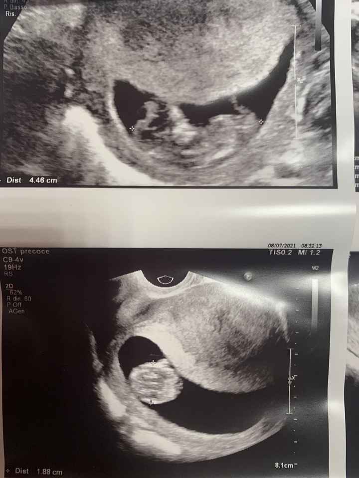 Nub theory. Maschio o femmina?💙🎀 - 3