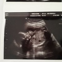 Mamme di Agosto 2020😍🤞😍 - 1