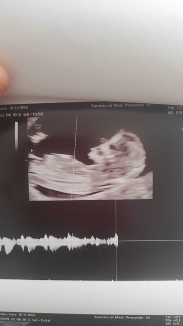 Future mamme Dicembre 2022 - 1